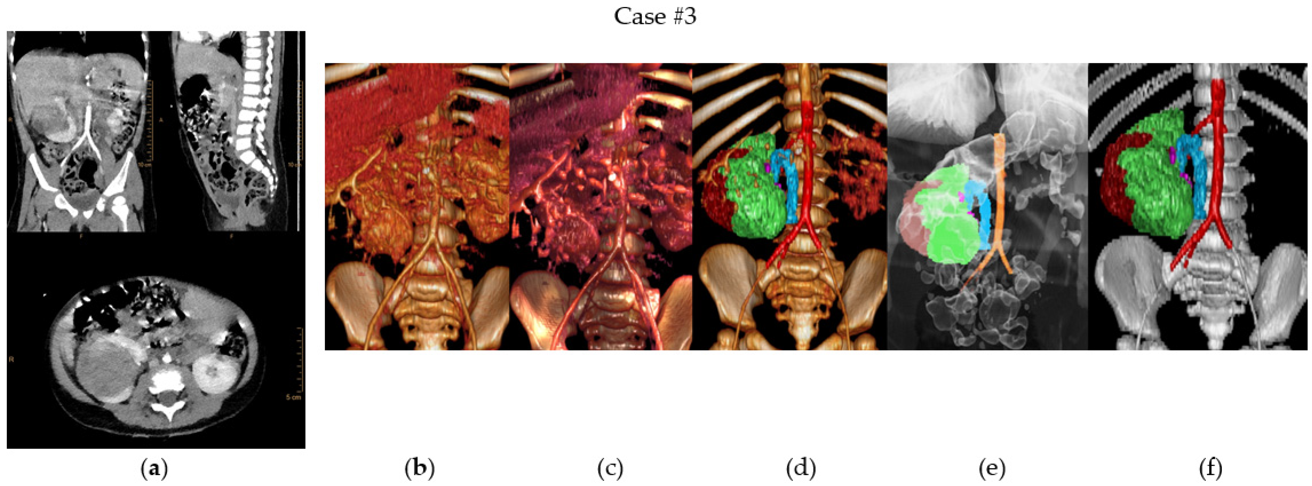 Children 10 00832 g003b