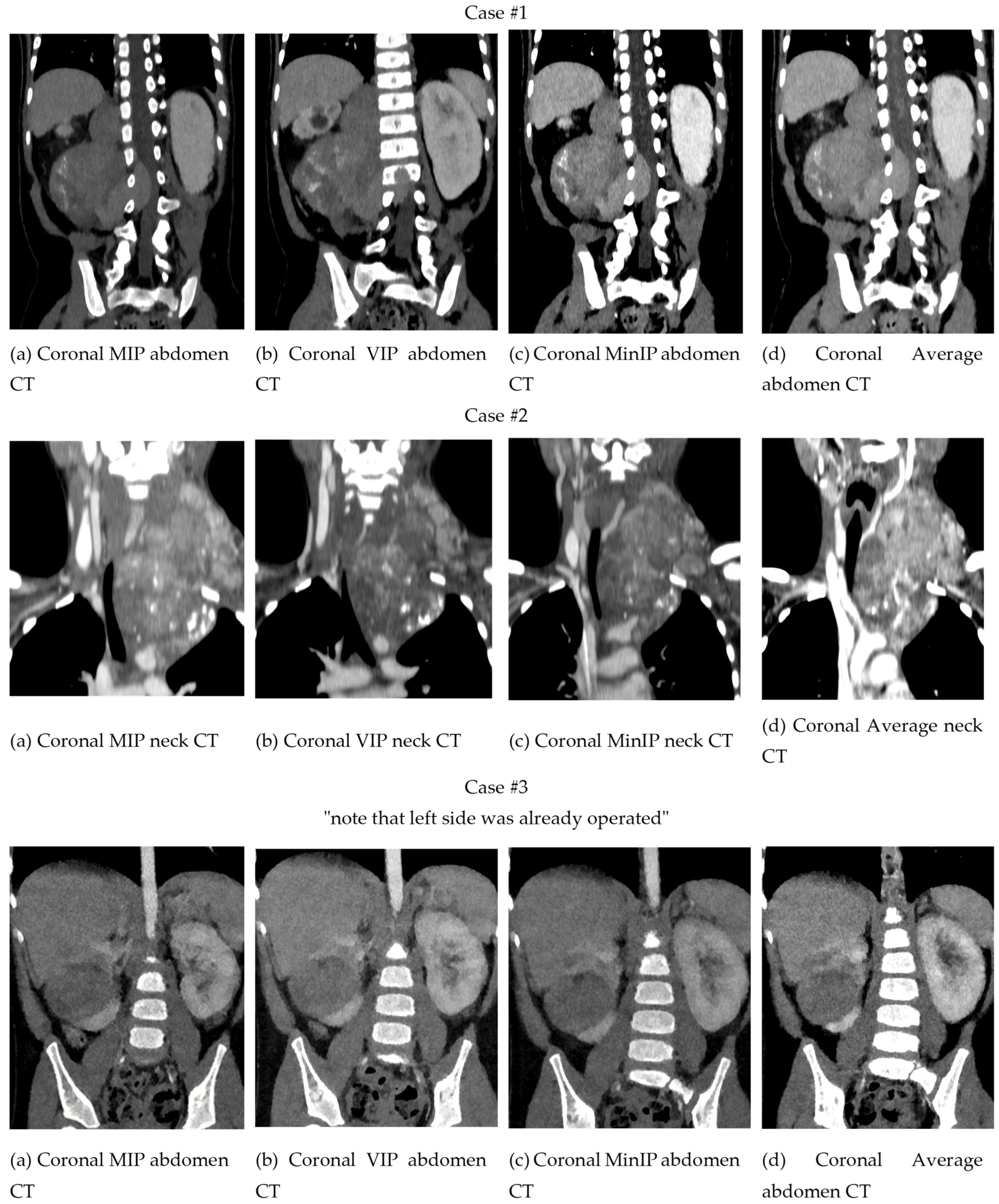 Children 10 00832 g004