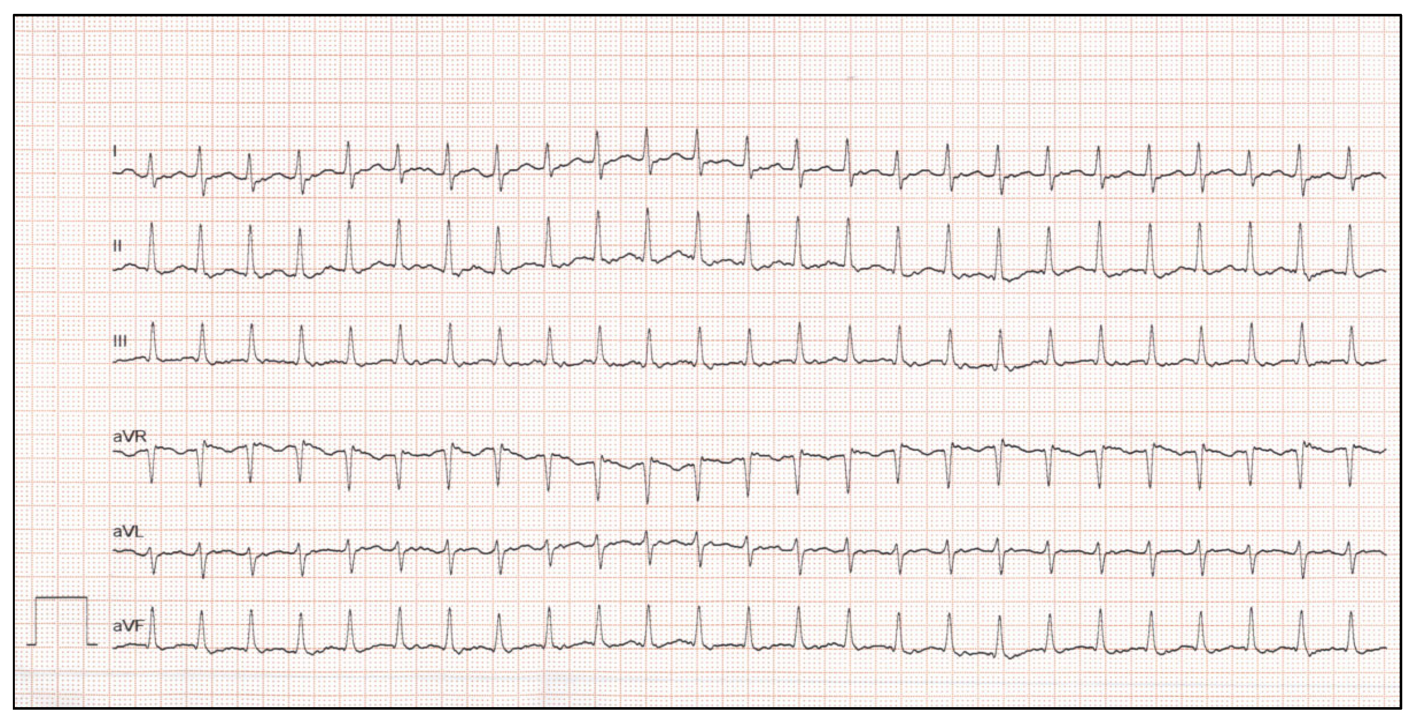 Children 10 00838 g002 Children 10 00838 g002