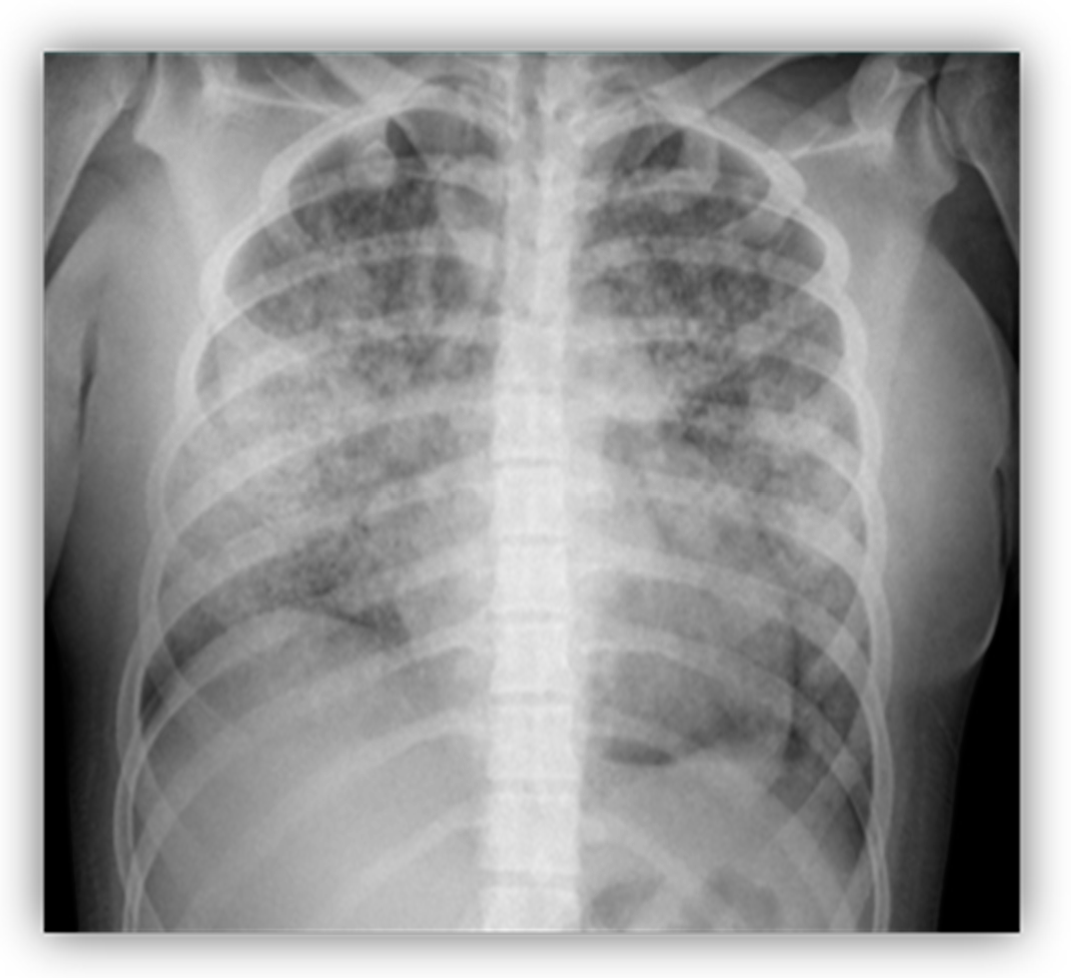 Children 10 00852 g001 Children 10 00852 g001