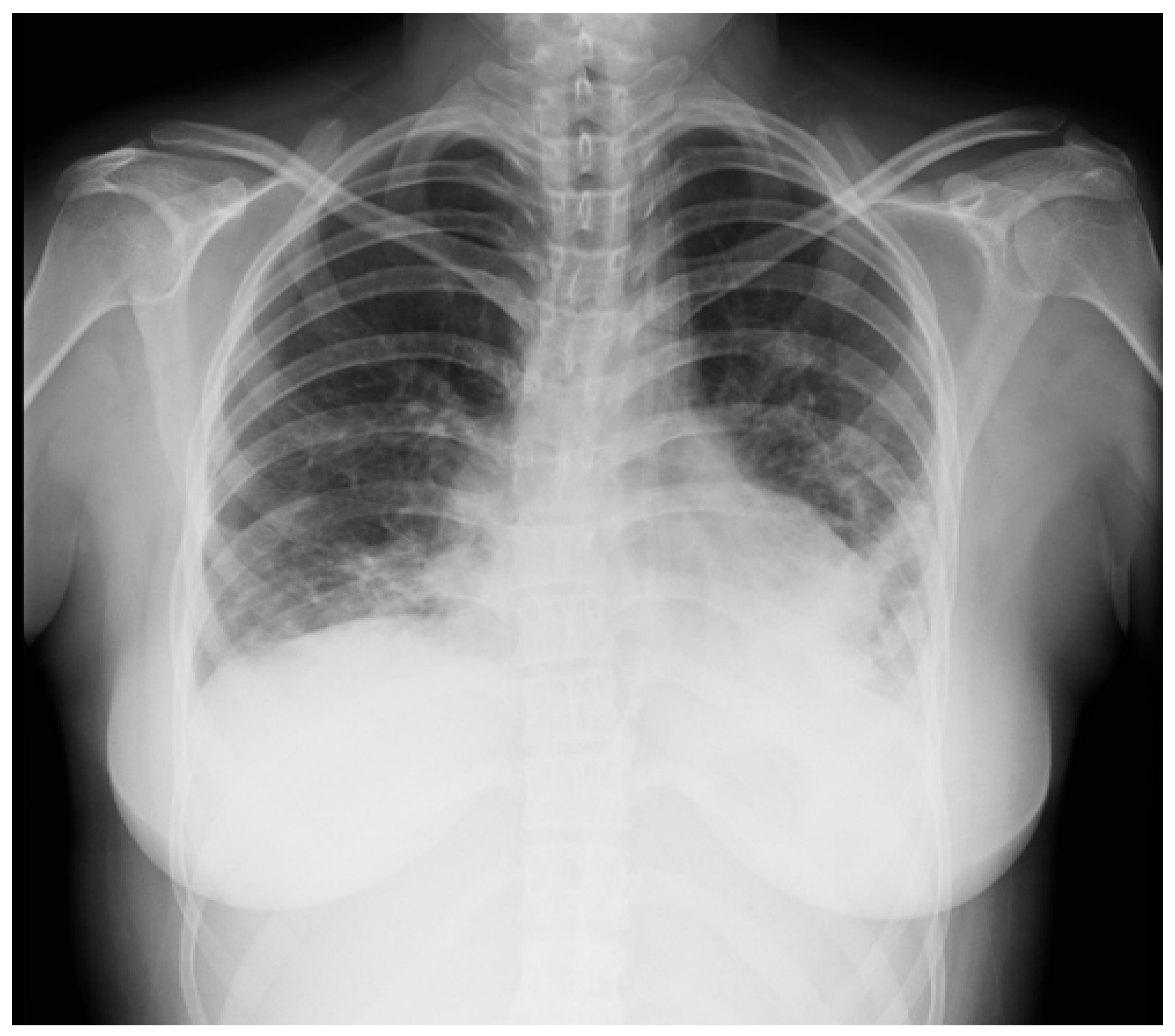 Children 10 00852 g002 Children 10 00852 g002