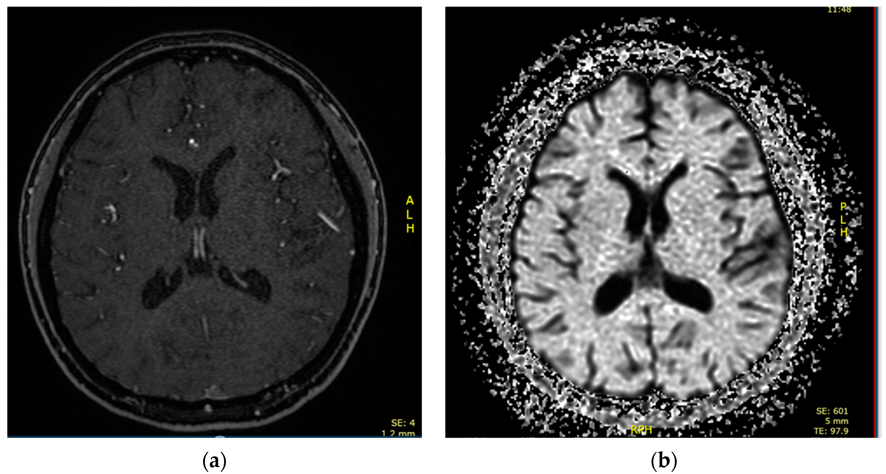 Children 10 00852 g003 Children 10 00852 g003