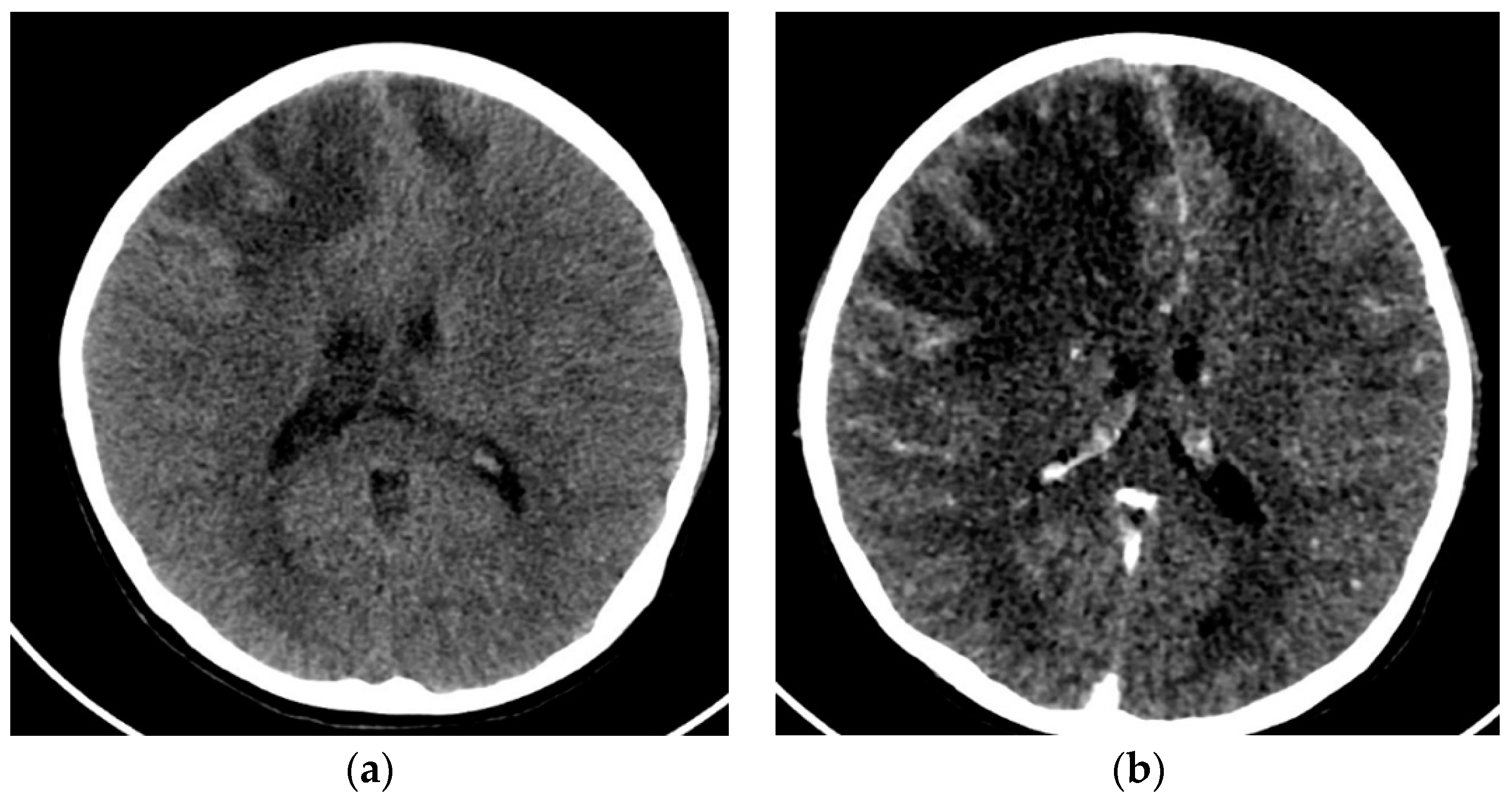 Children 10 00852 g004 Children 10 00852 g004