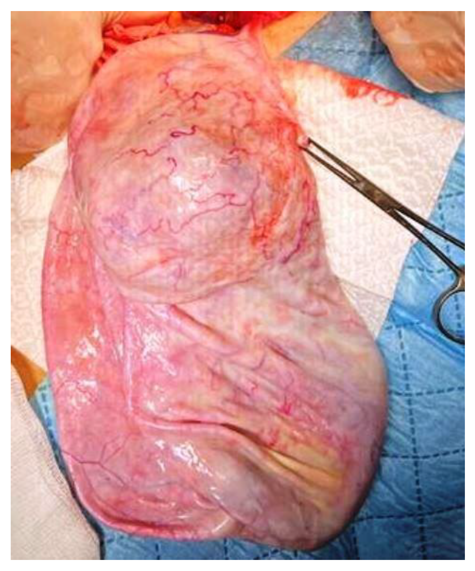 Children 10 00856 g004