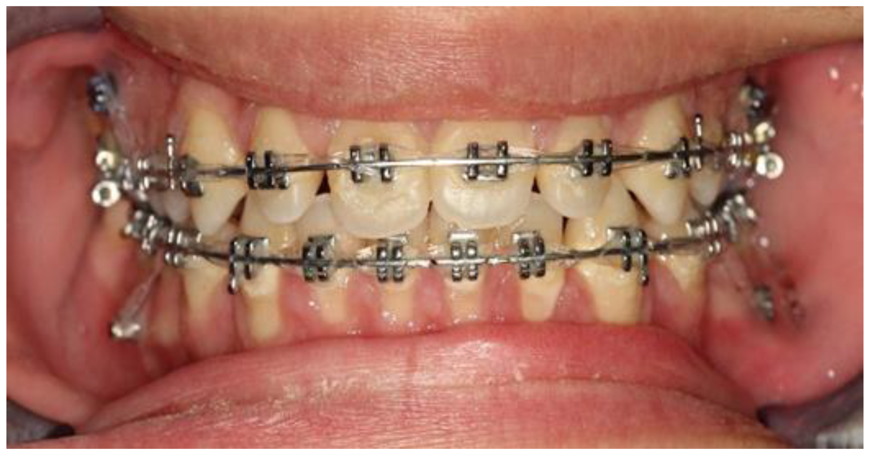 Children 10 00879 g008