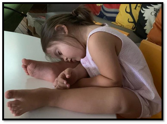 その他 Sleep Disturbance in Children Common Sleep Disorders in Kids - Dr. Mayank Shukla