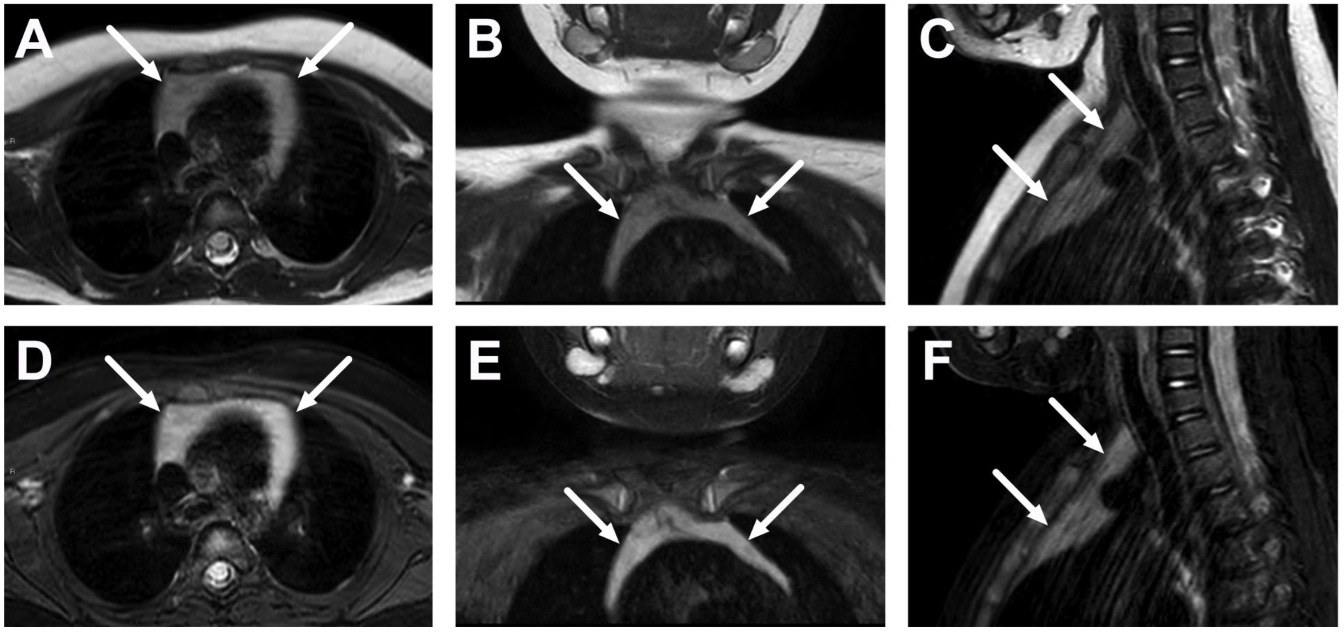 Children 10 00967 g004 Children 10 00967 g004