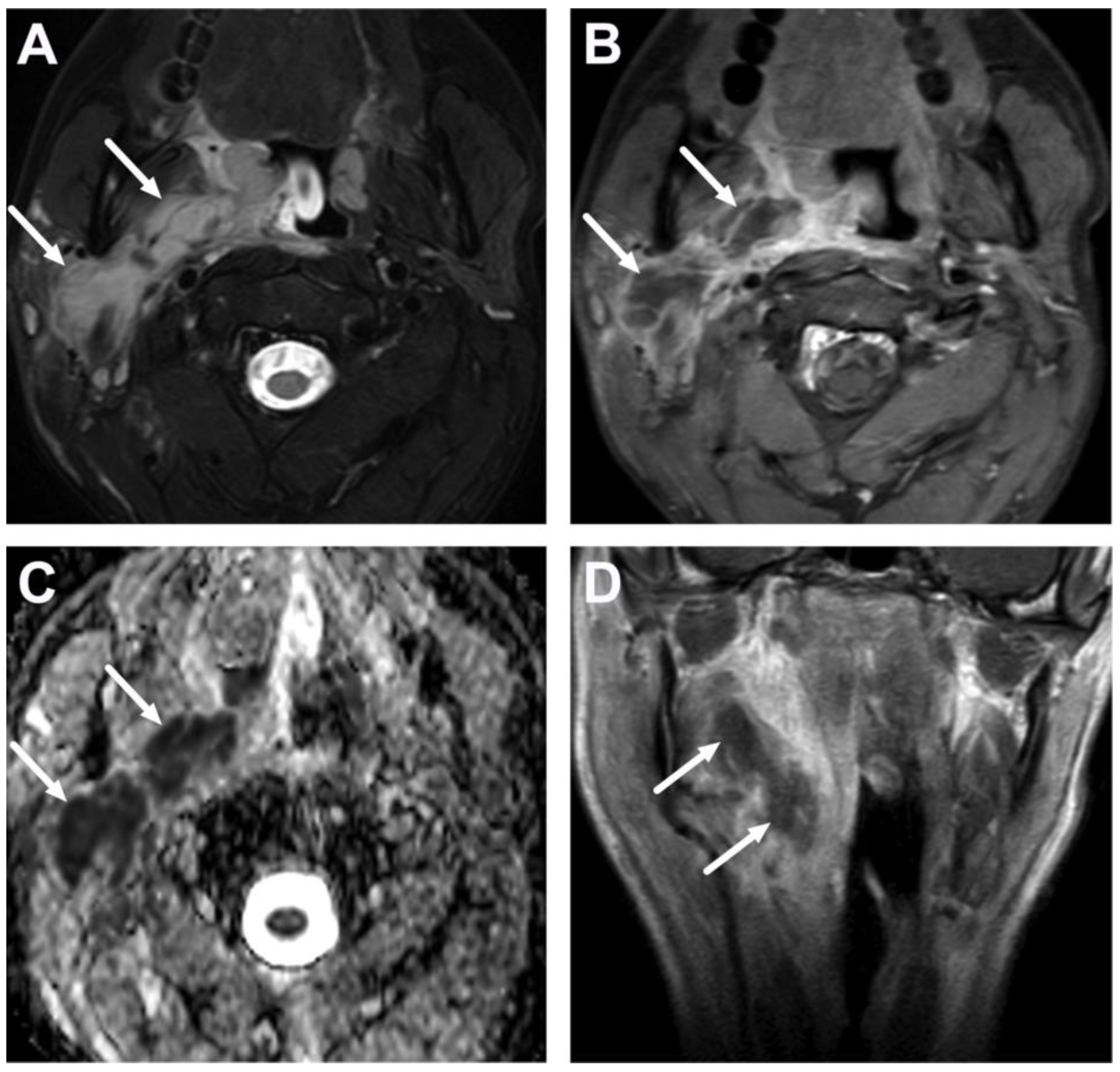 Children 10 00967 g009 Children 10 00967 g009