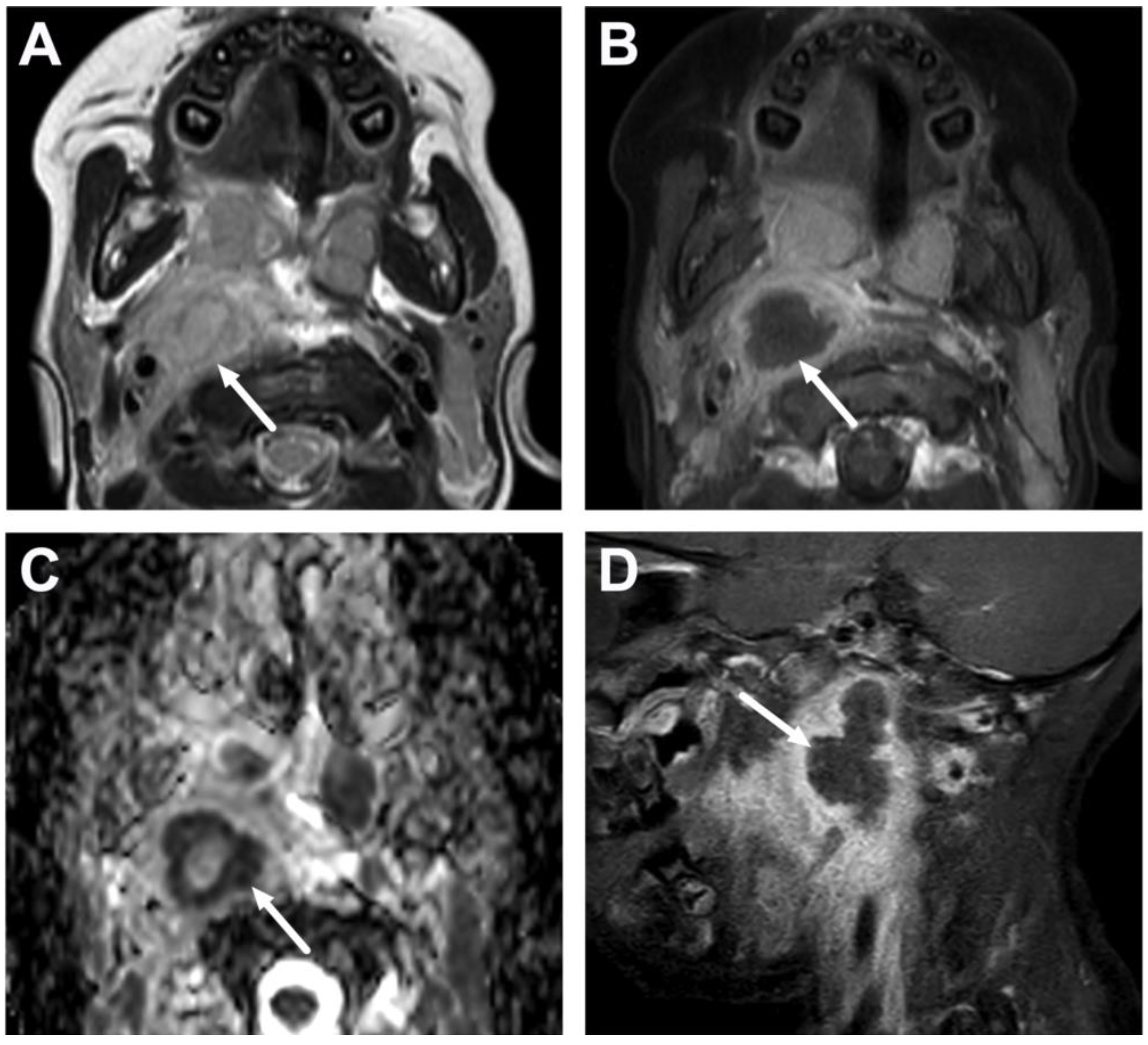 Children 10 00967 g011 Children 10 00967 g011