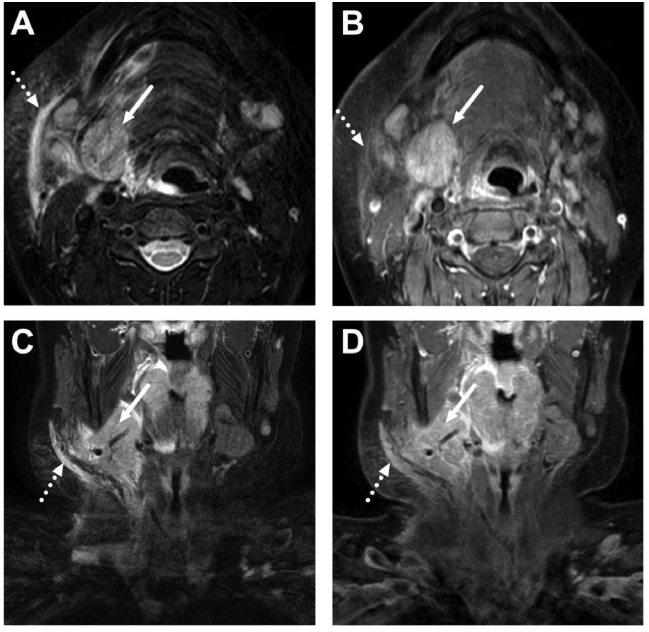 Children 10 00967 g017 Children 10 00967 g017