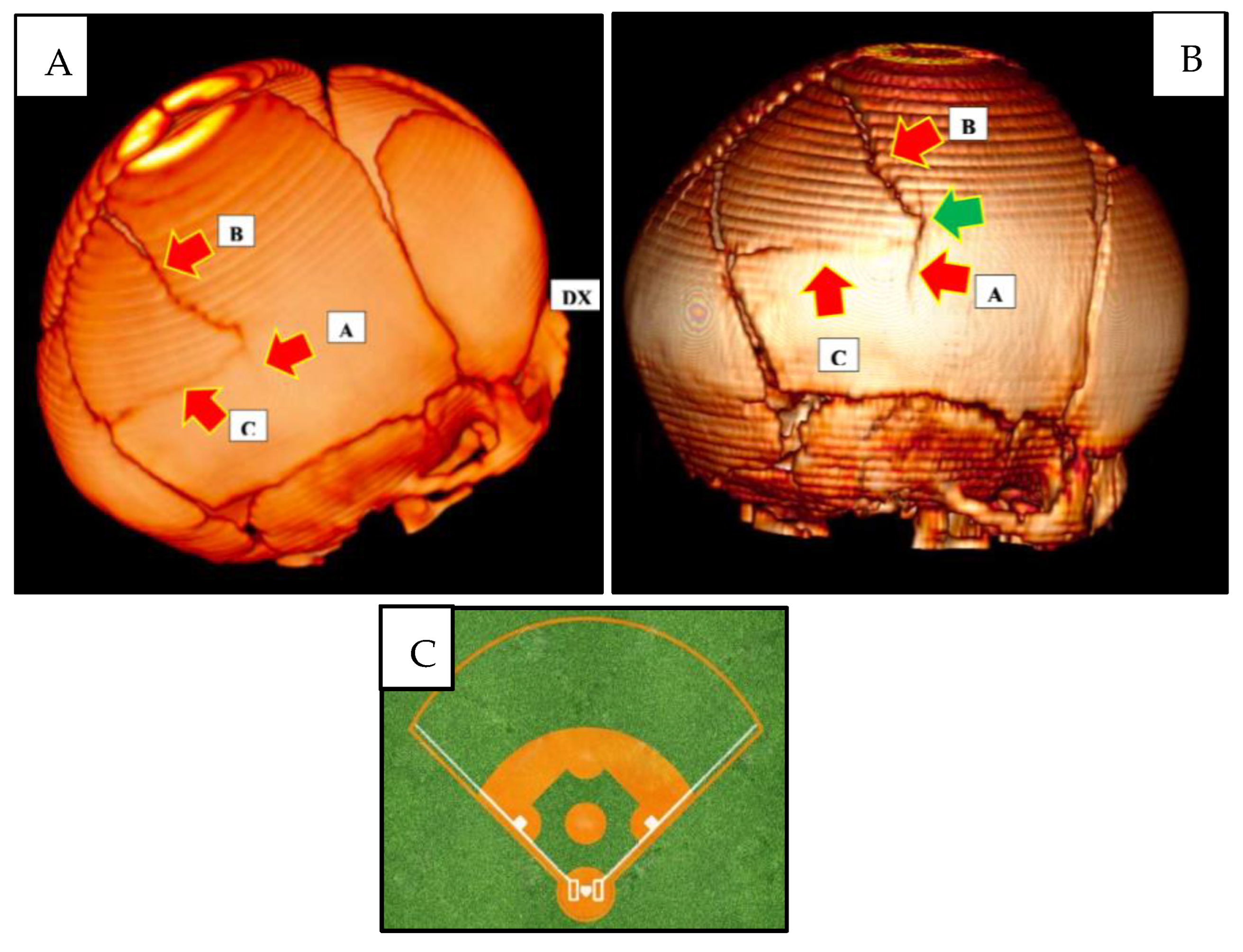 Children 10 01003 g002