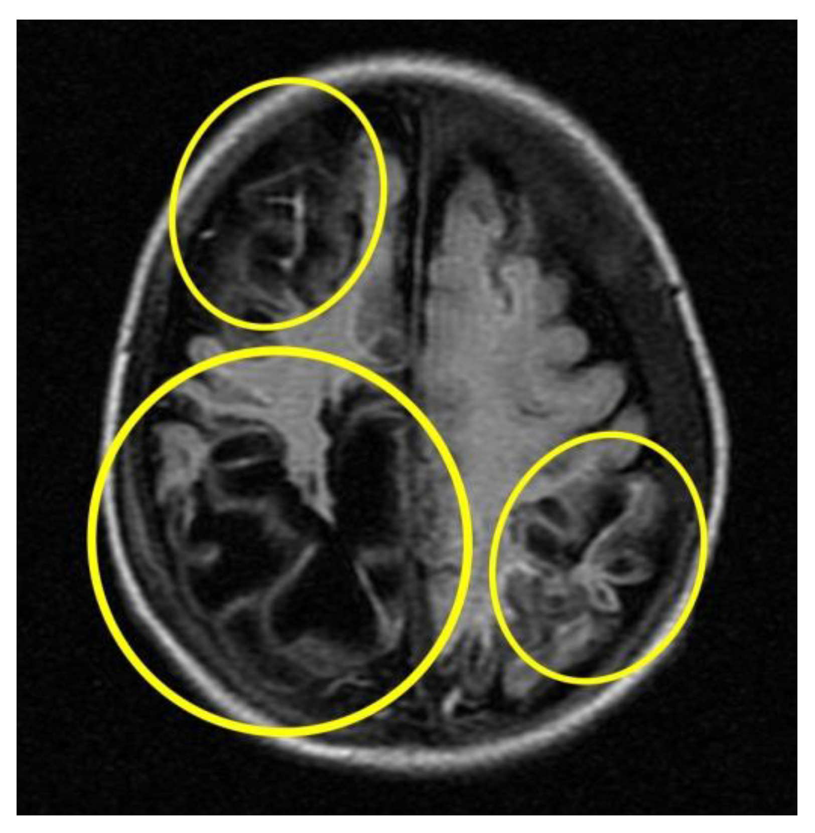 Children 10 01003 g005