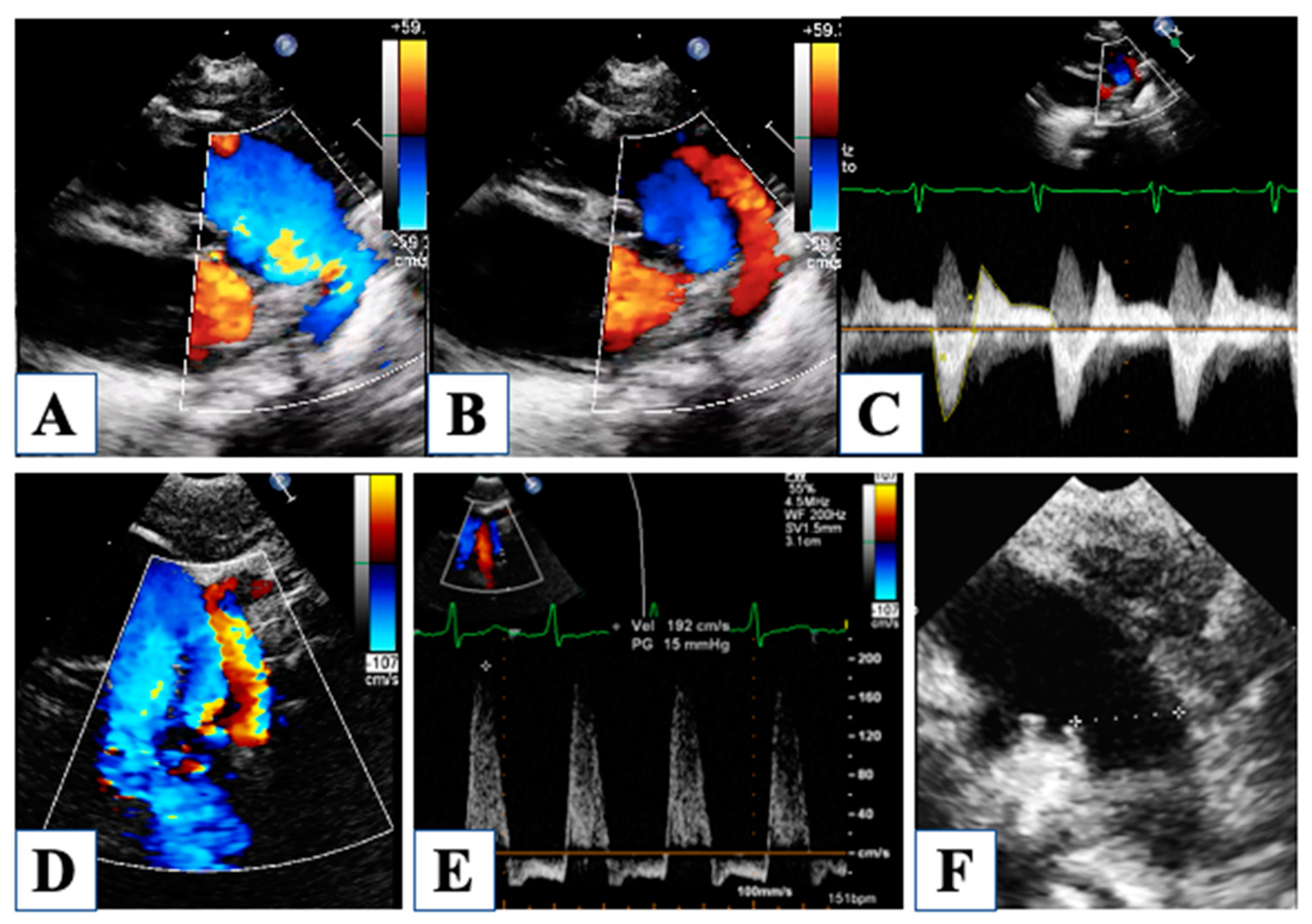 Children 10 01012 g002 Children 10 01012 g002