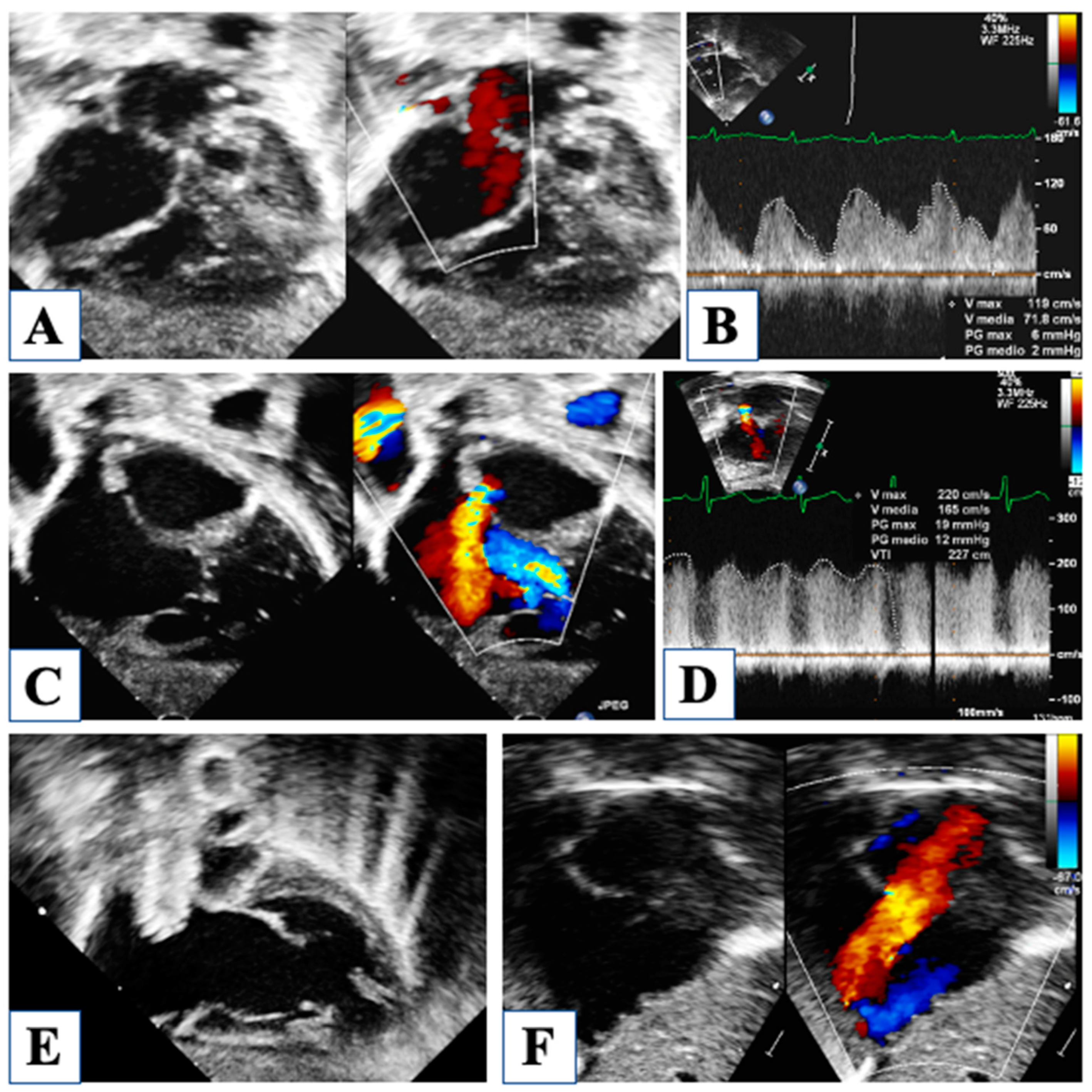 Children 10 01012 g003 Children 10 01012 g003