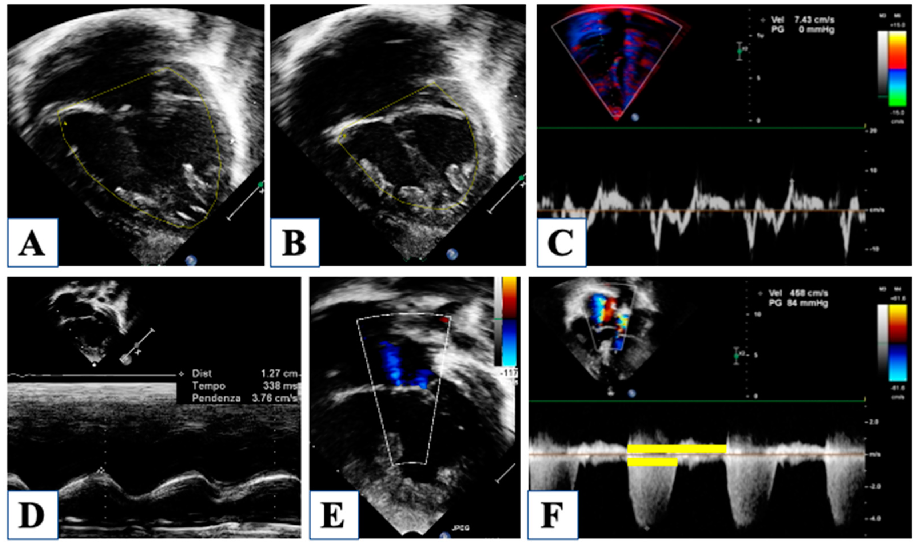 Children 10 01012 g004 Children 10 01012 g004