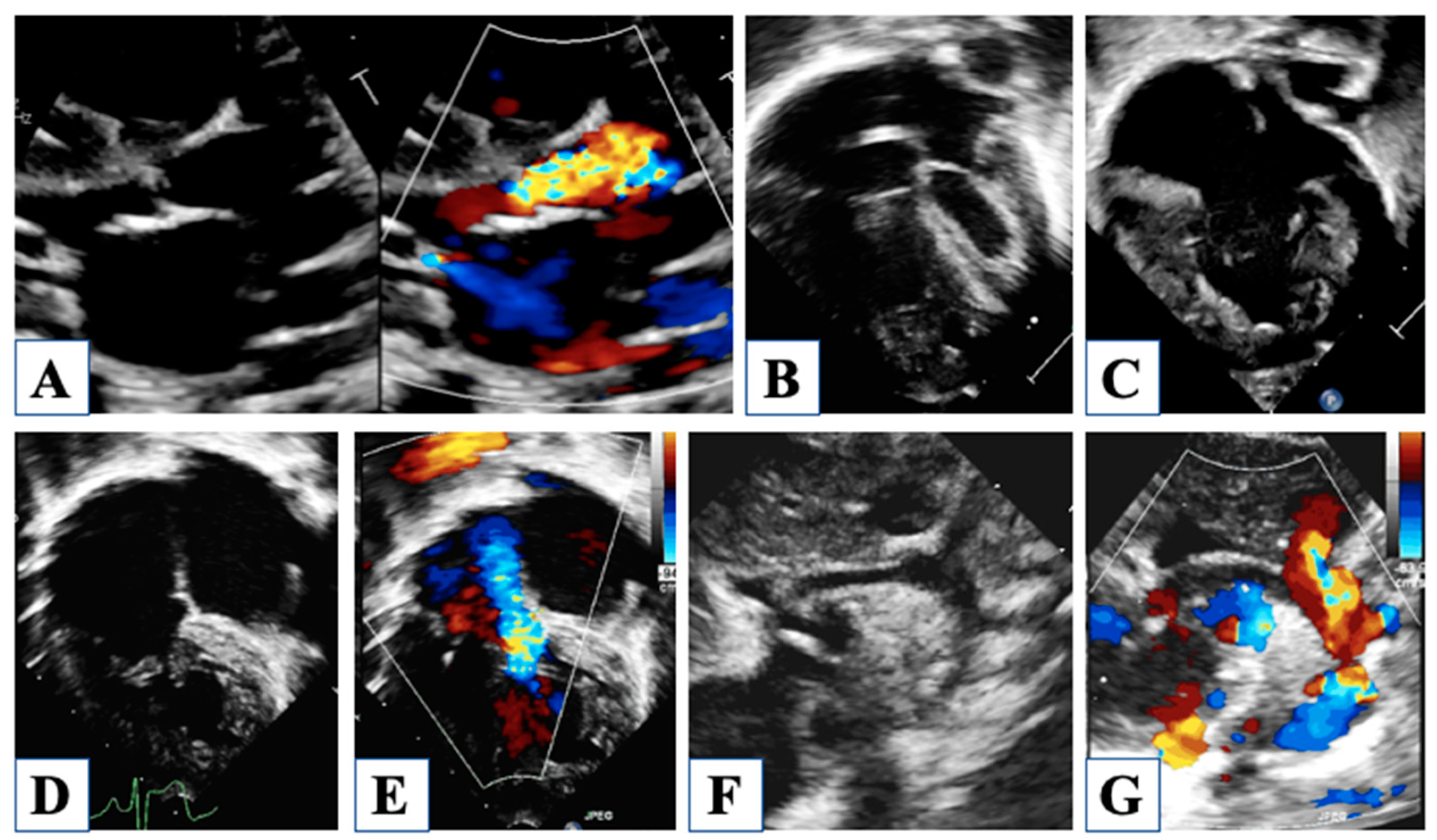 Children 10 01012 g005 Children 10 01012 g005