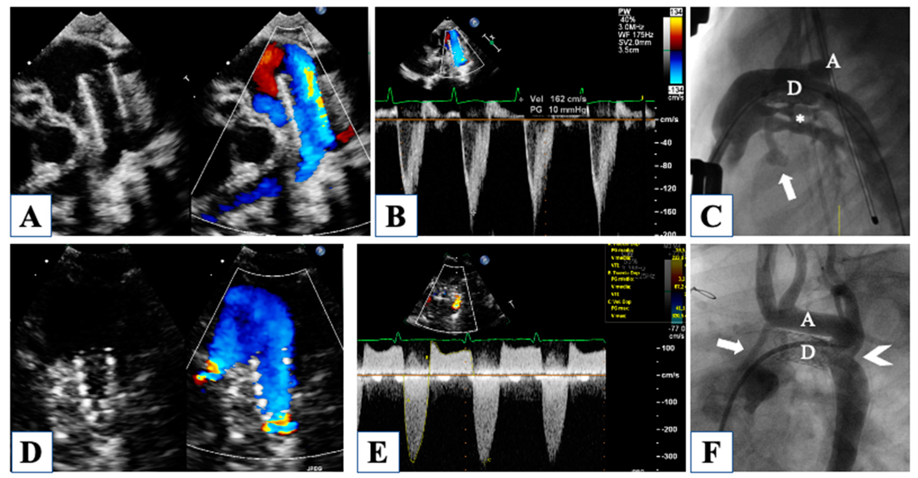 Children 10 01012 g006 Children 10 01012 g006