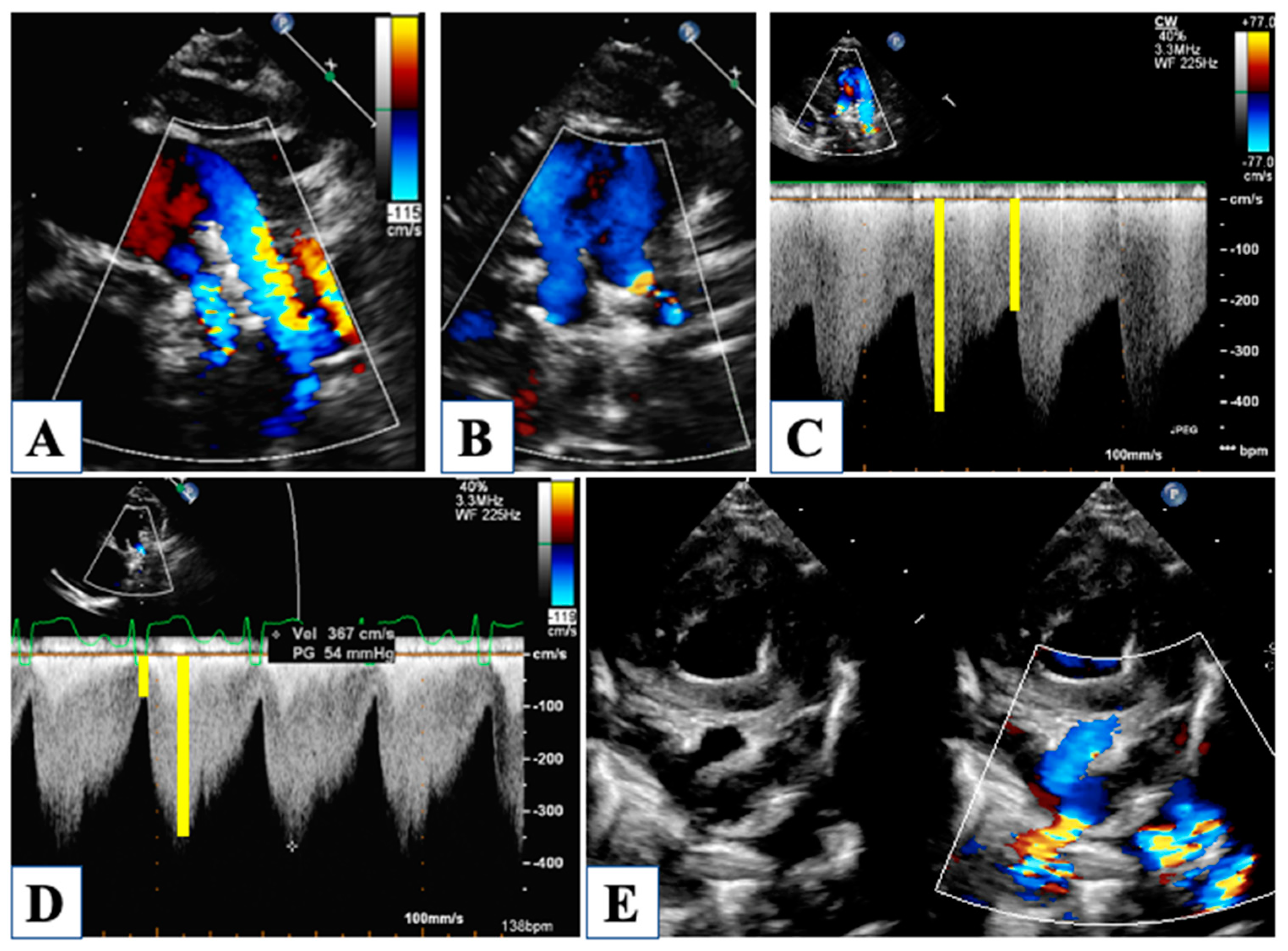 Children 10 01012 g007 Children 10 01012 g007
