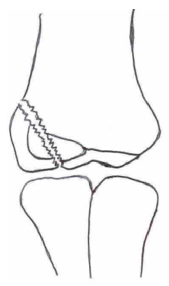 Children 10 01033 i001