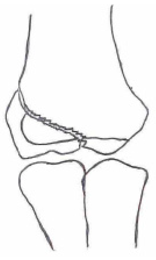 Children 10 01033 i002