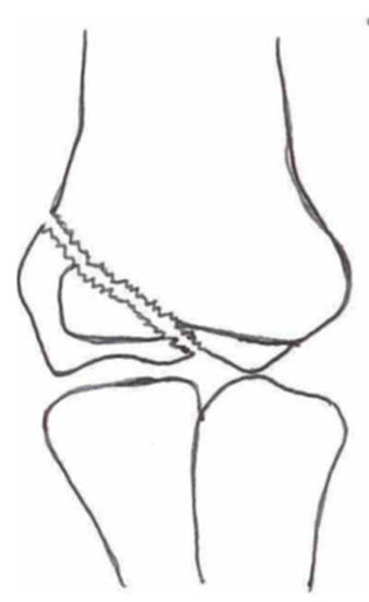 Children 10 01033 i004