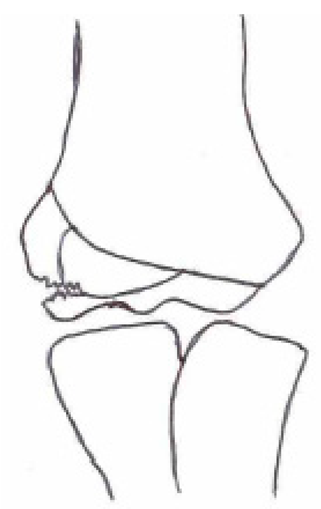 Children 10 01033 i006