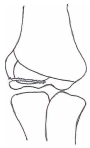 Children 10 01033 i007