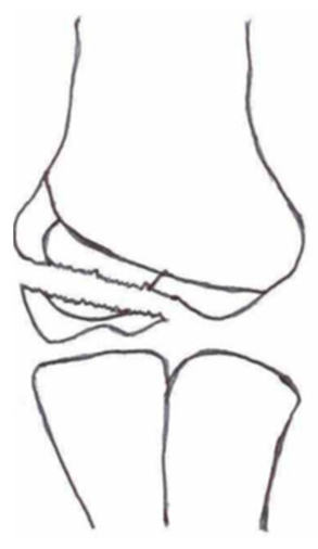 Children 10 01033 i008