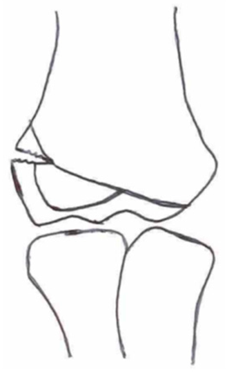 Children 10 01033 i009