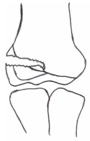 Children 10 01033 i010