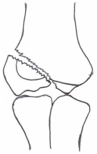 Children 10 01033 i011