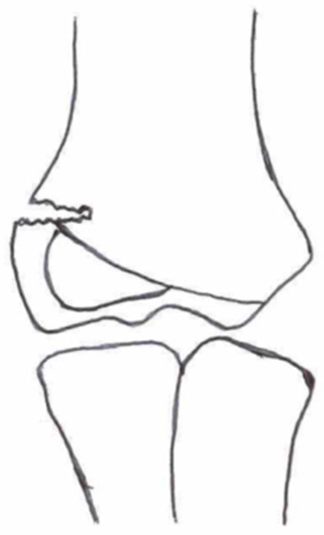 Children 10 01033 i012