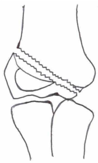 Children 10 01033 i014