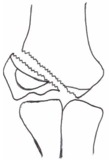 Children 10 01033 i015