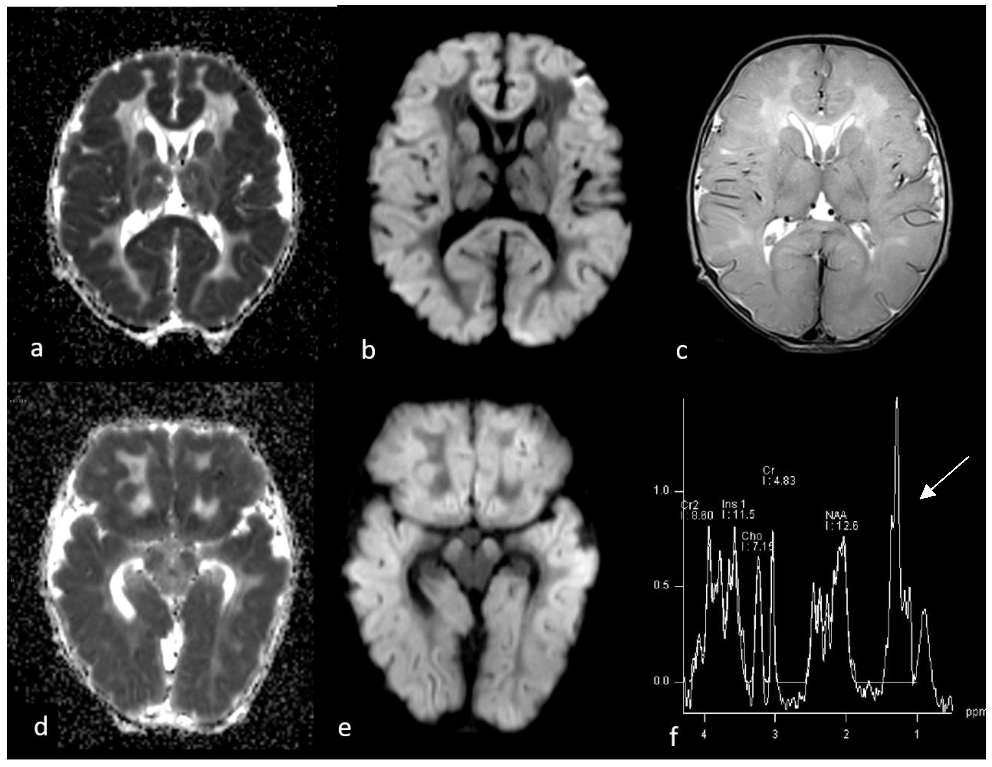 Children 10 01072 g001 Children 10 01072 g001