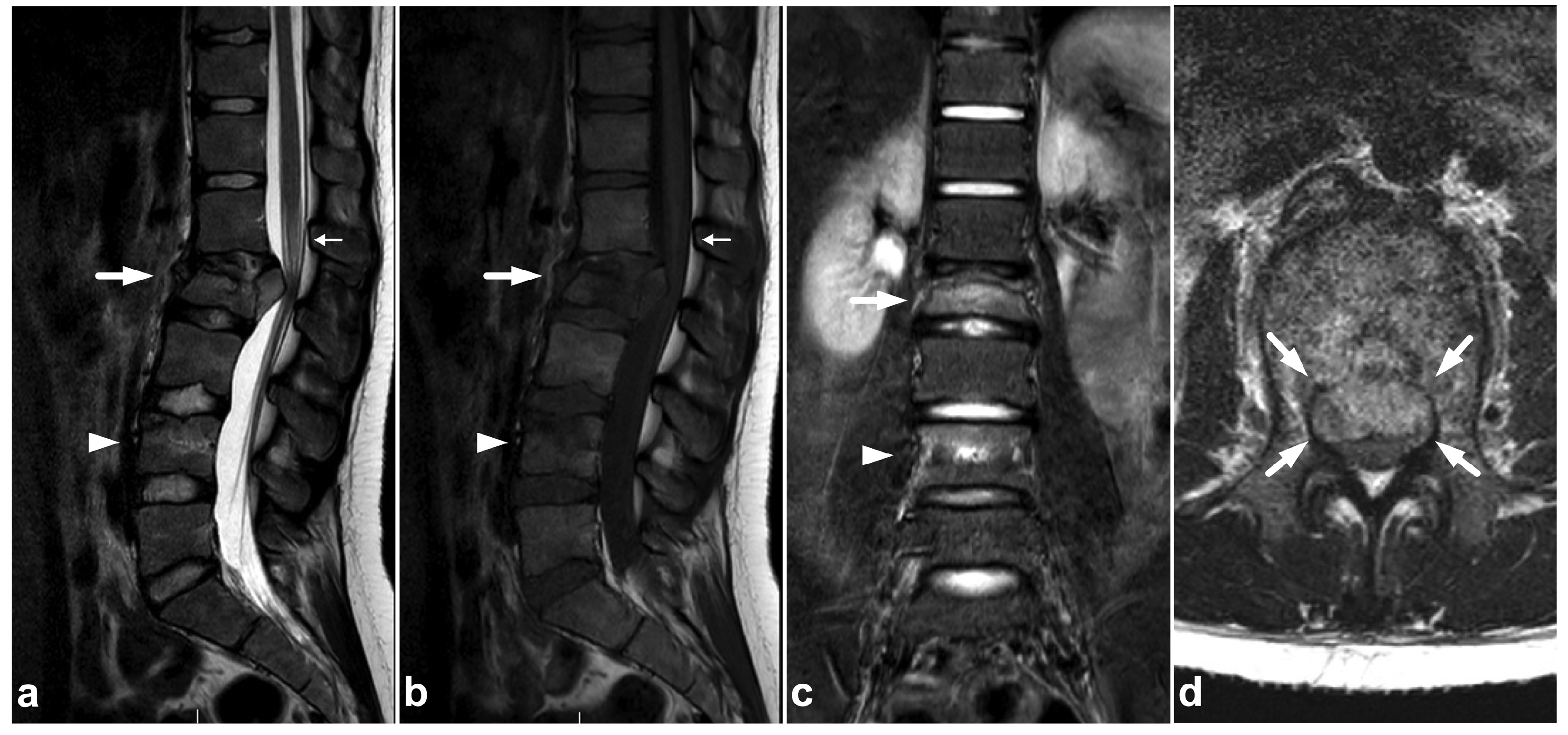 Children 10 01094 g002 Children 10 01094 g002