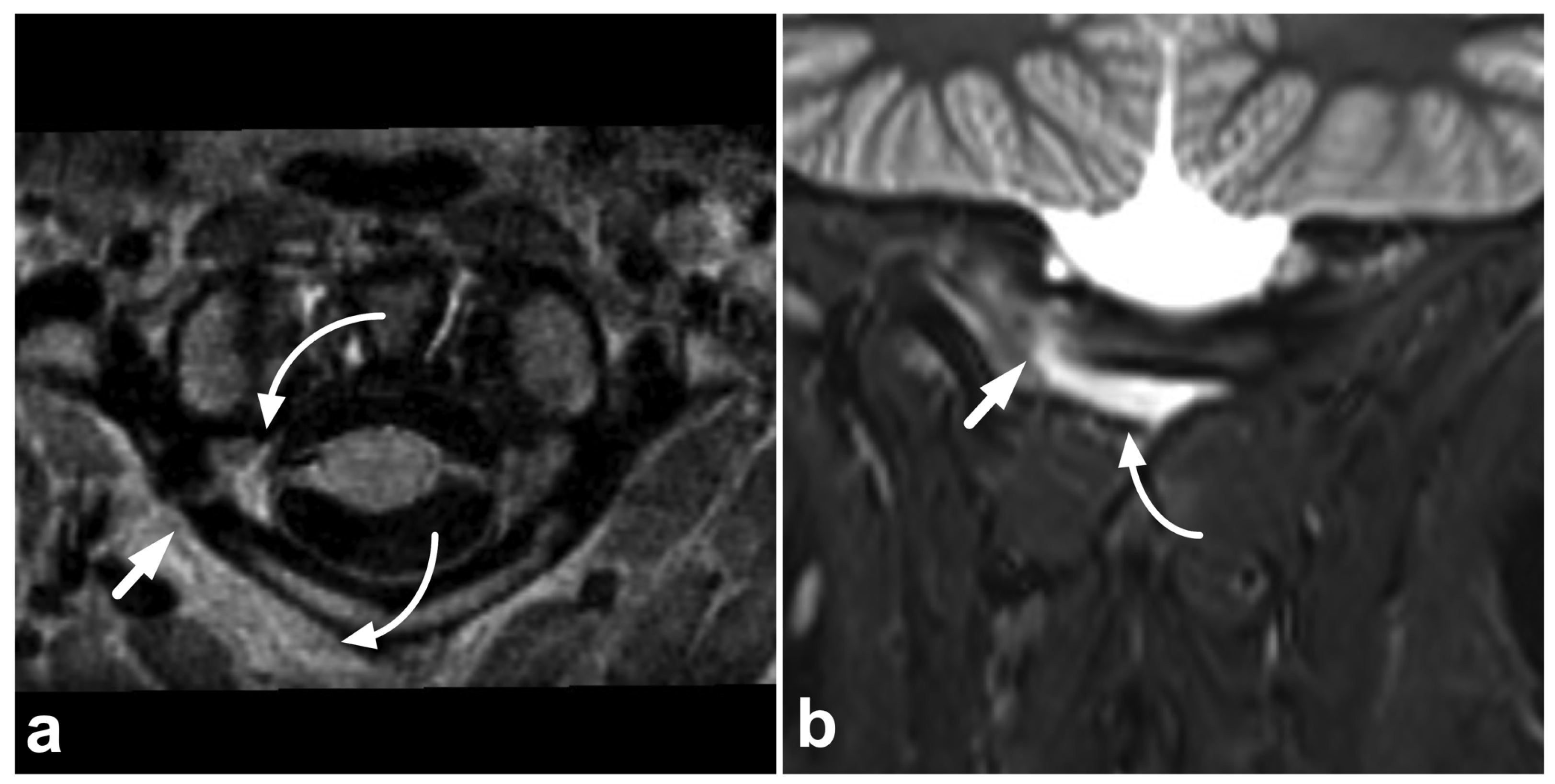 Children 10 01094 g006a Children 10 01094 g006a