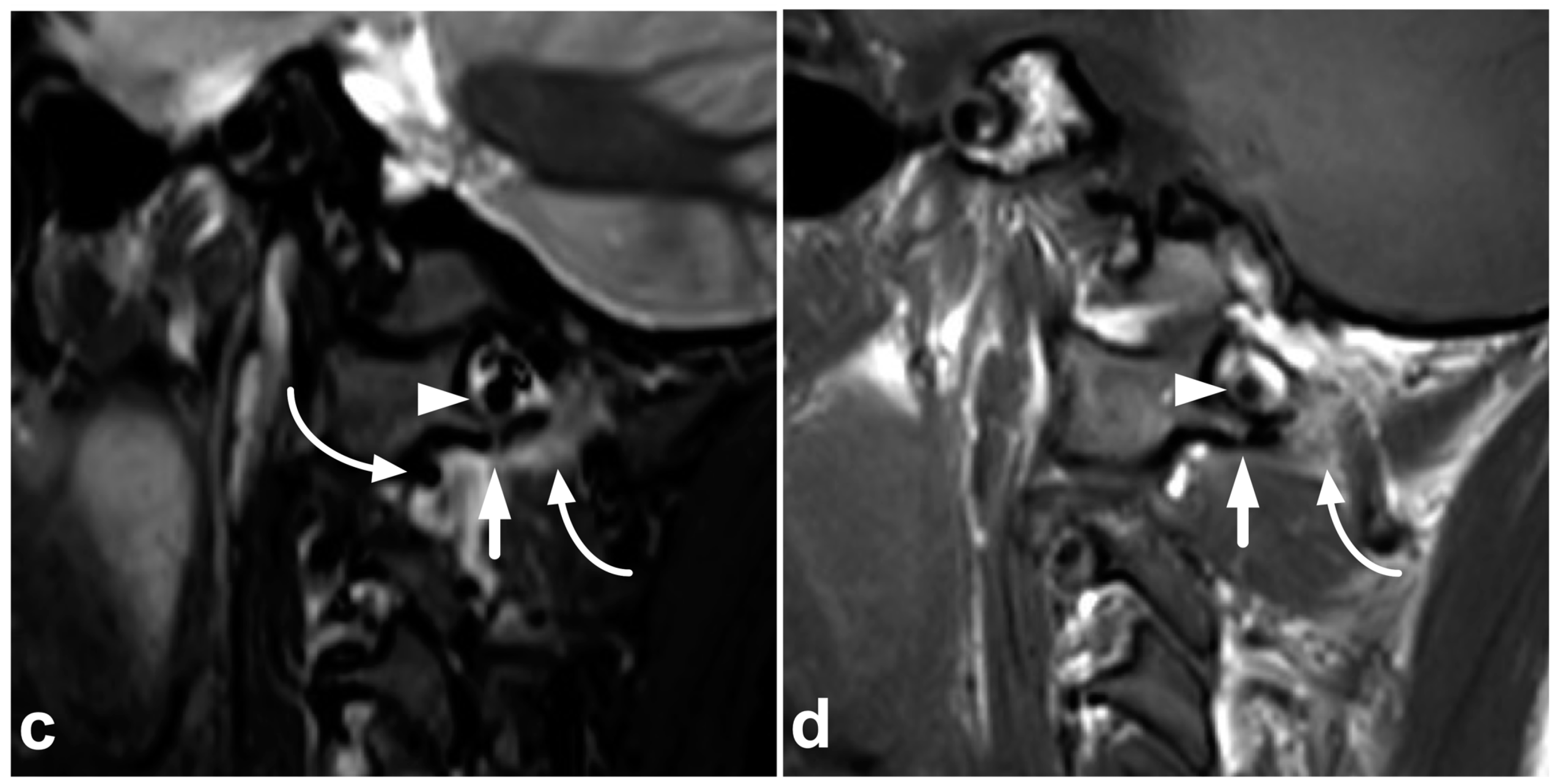 Children 10 01094 g006b Children 10 01094 g006b