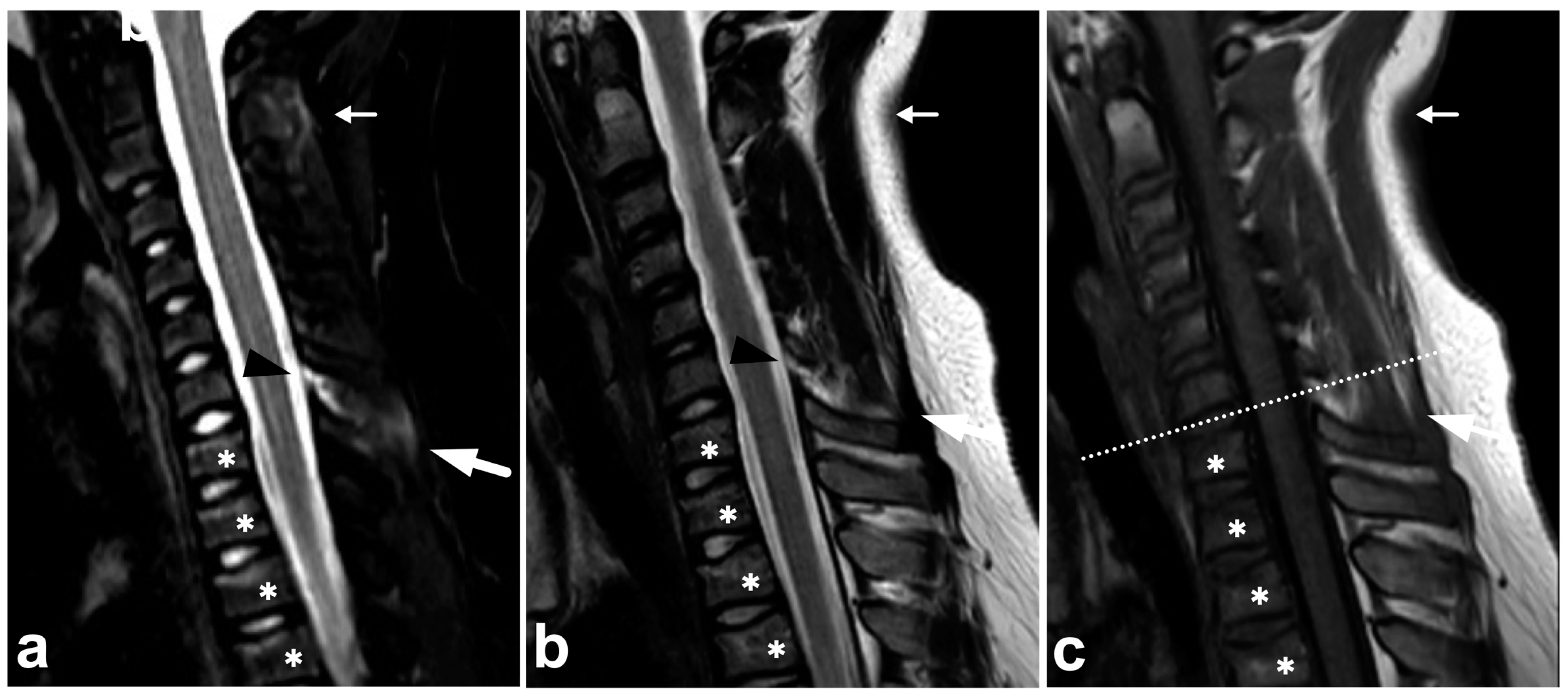 Children 10 01094 g009a Children 10 01094 g009a