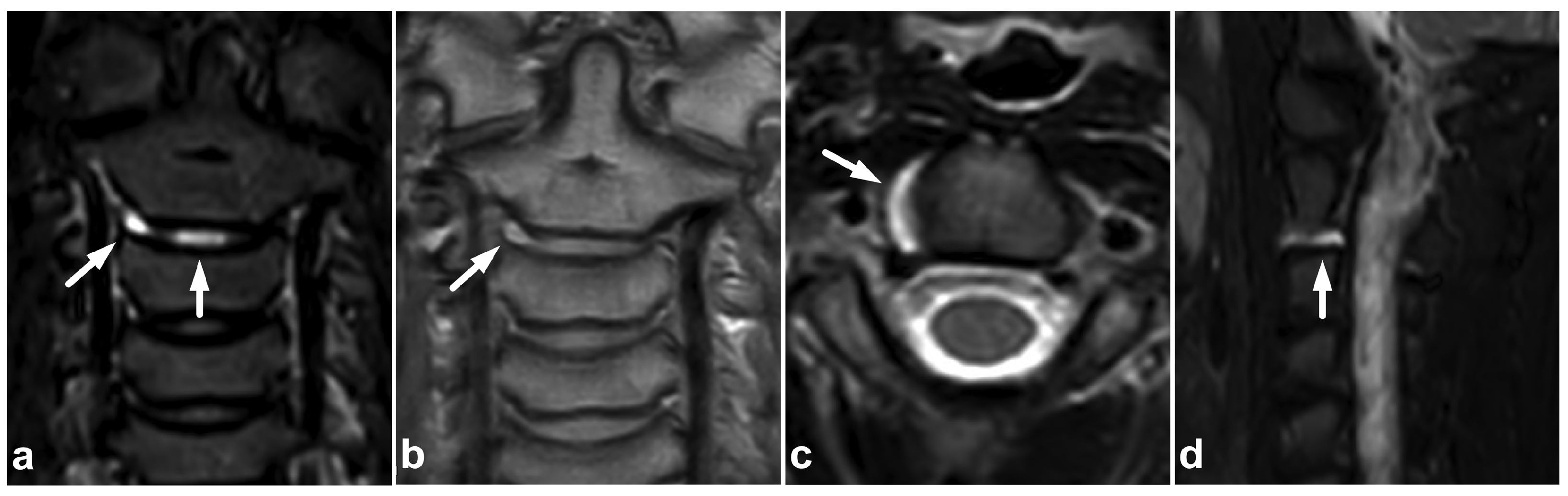 Children 10 01094 g011 Children 10 01094 g011