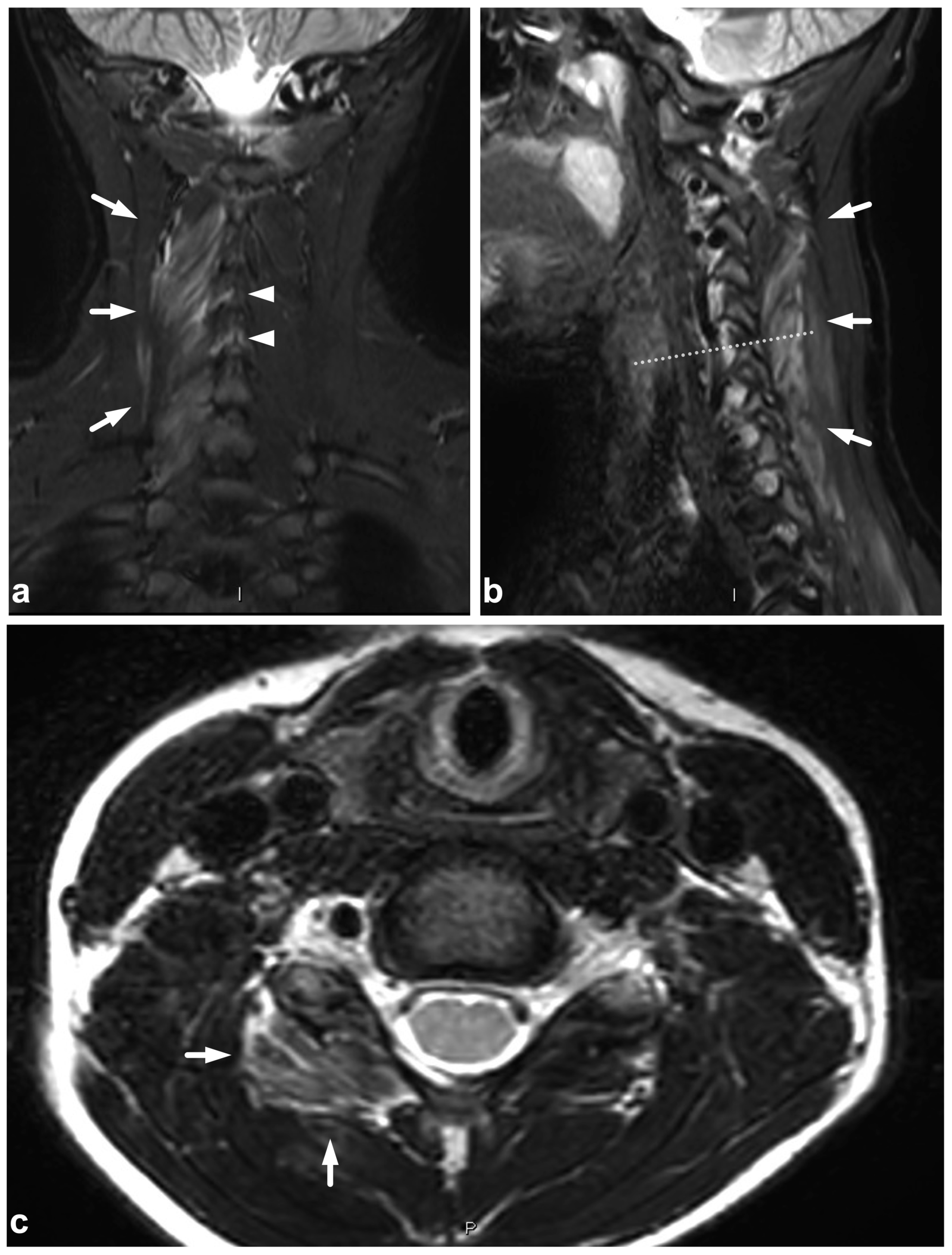 Children 10 01094 g012 Children 10 01094 g012