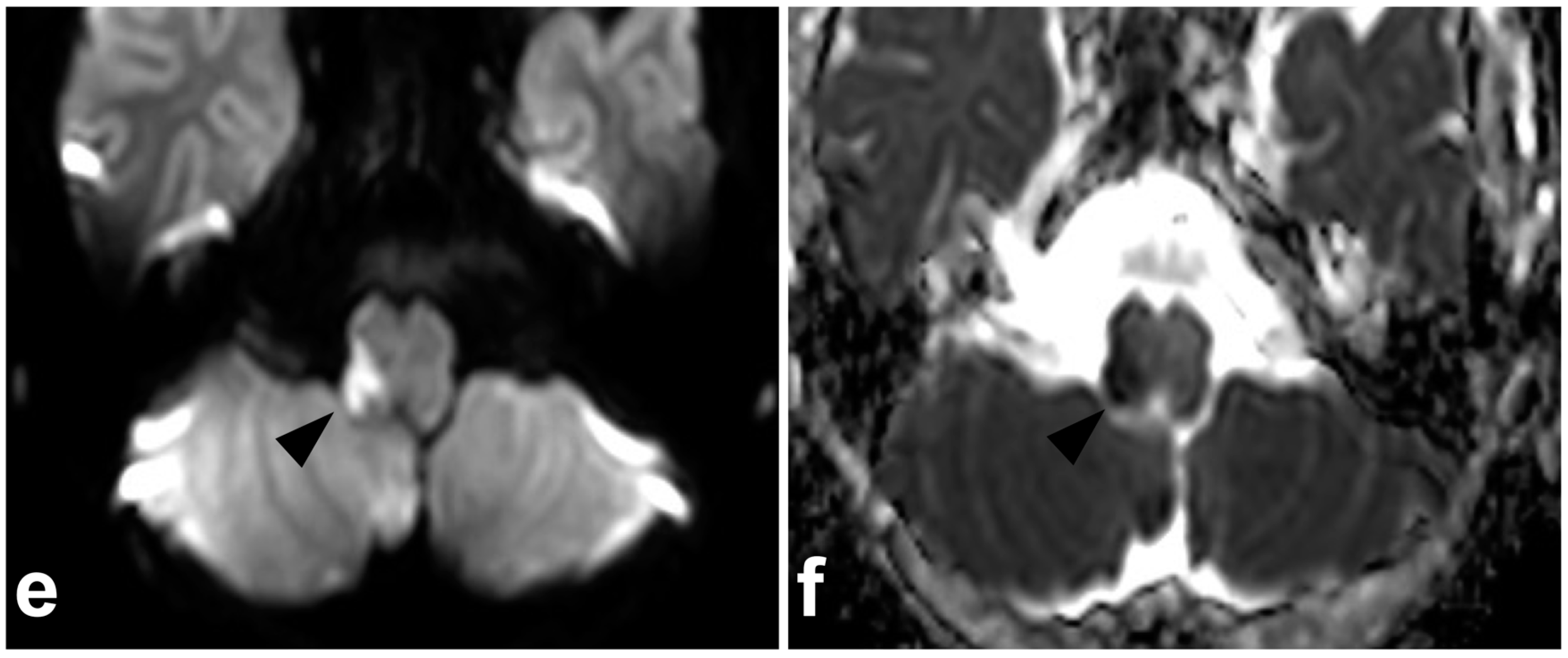 Children 10 01094 g014b Children 10 01094 g014b