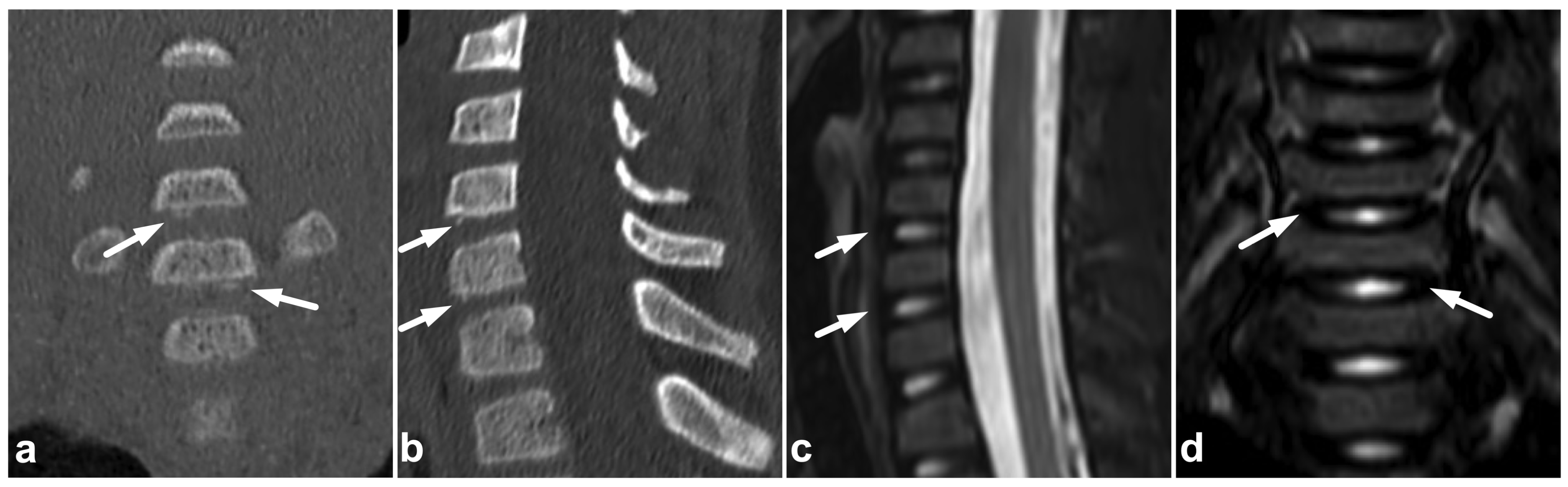 Children 10 01094 g021 Children 10 01094 g021