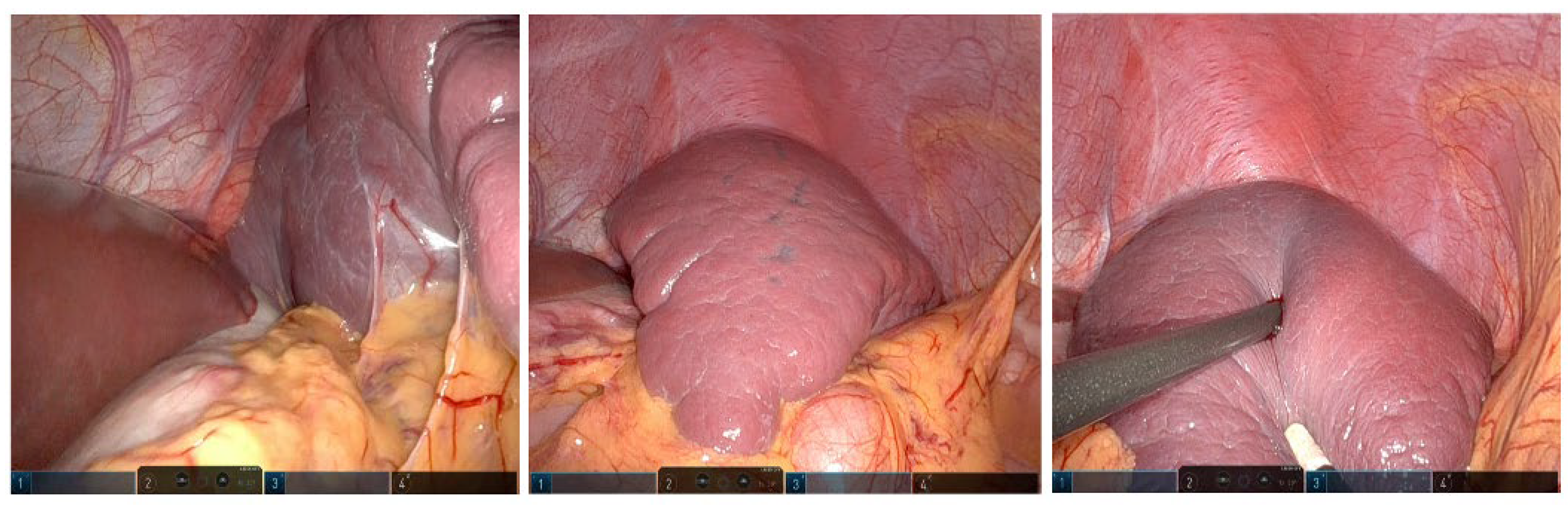 Children 10 01153 g003 Children 10 01153 g003