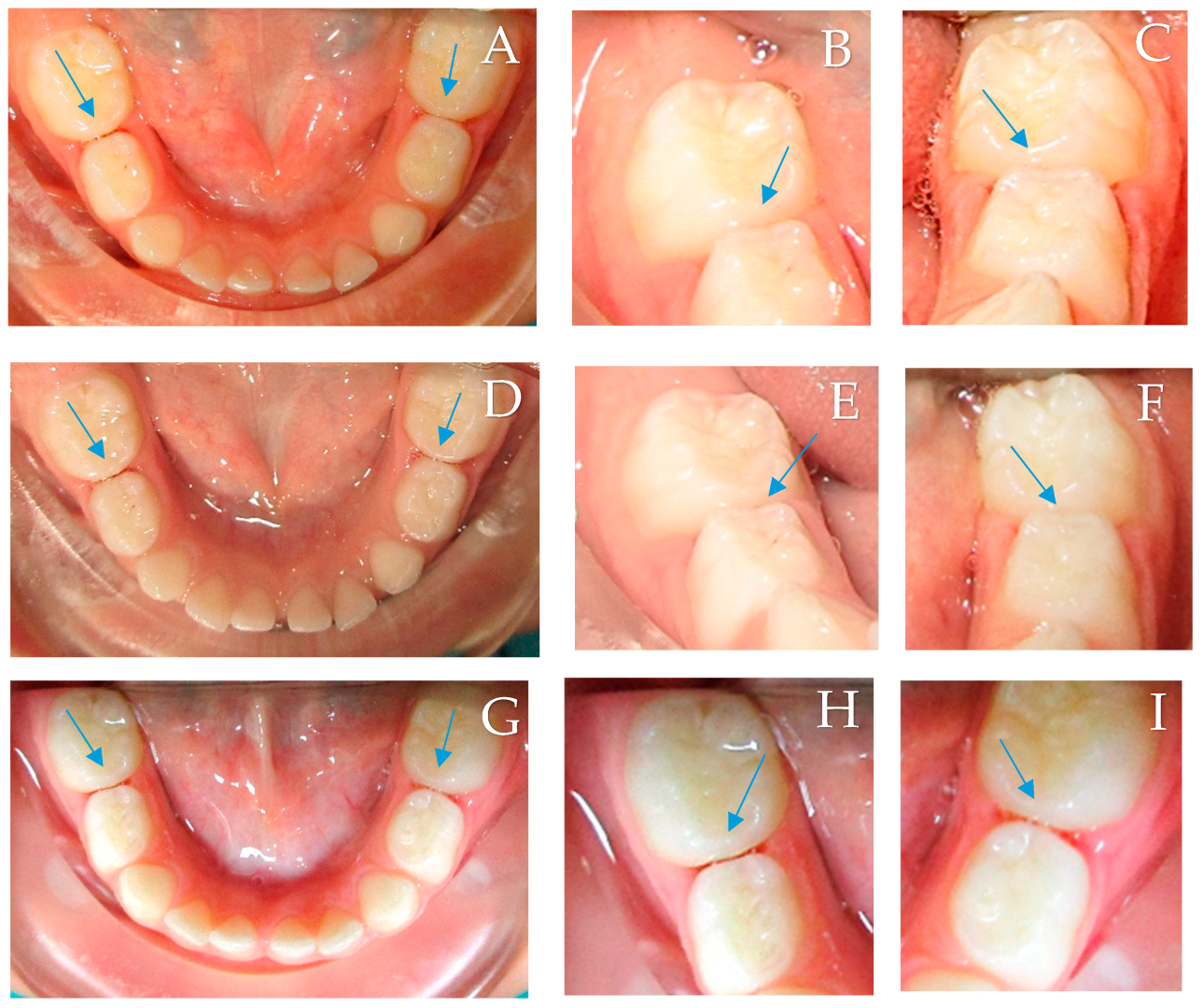 Children 10 01164 g003