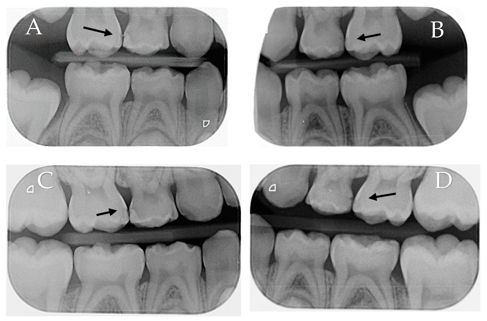 Children 10 01164 g004