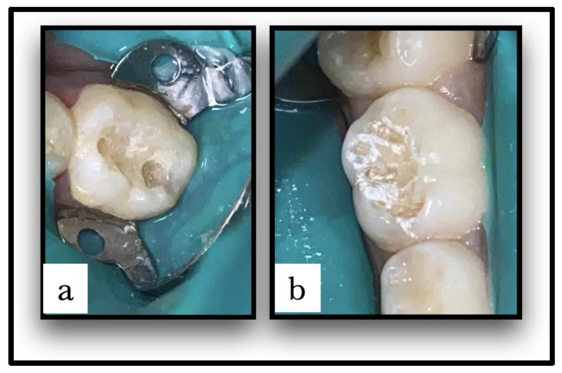 Children 10 01215 g001 Children 10 01215 g001