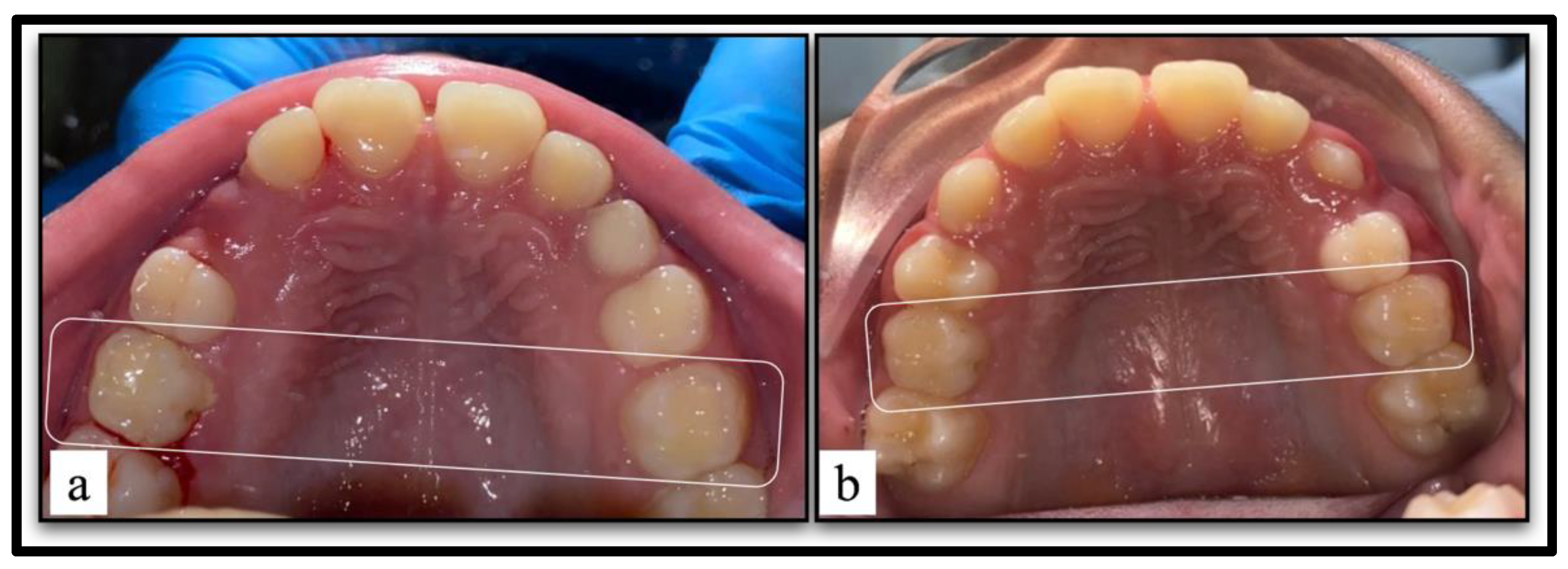 Children 10 01215 g002 Children 10 01215 g002