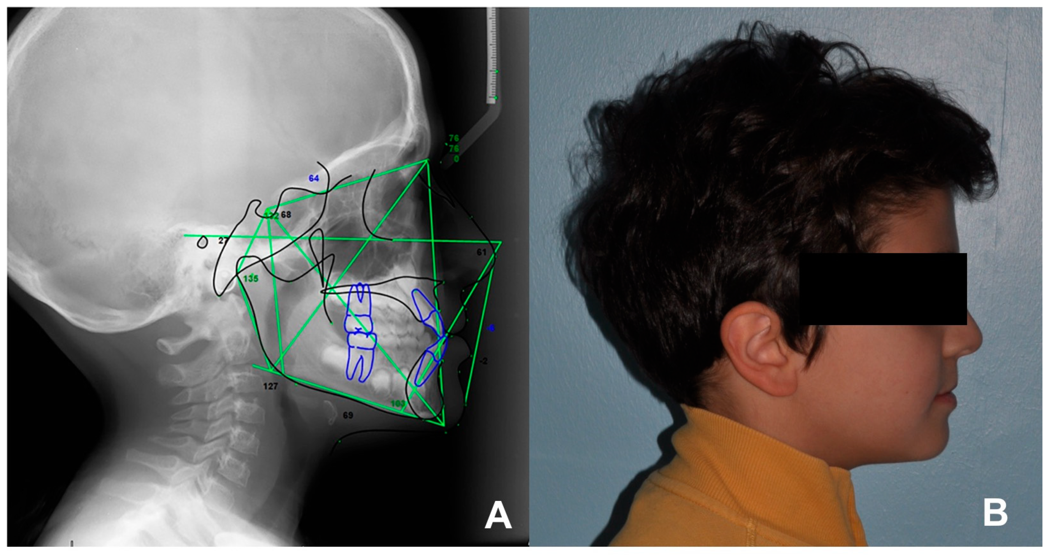 Children 10 01219 g005