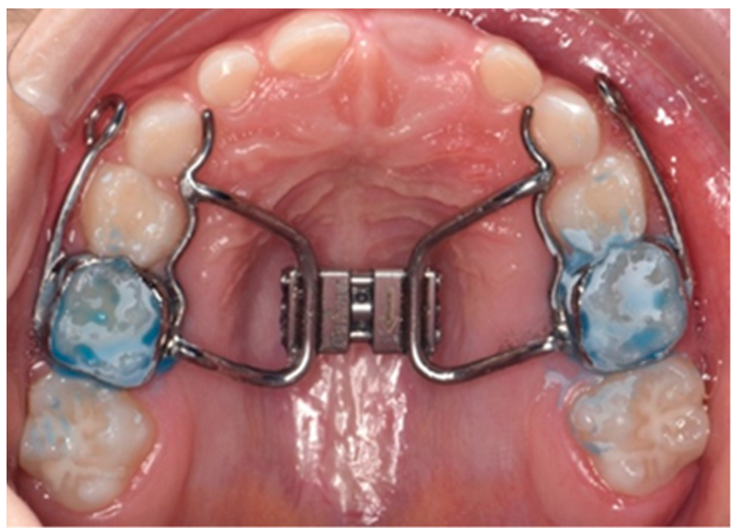 Children 10 01225 g003